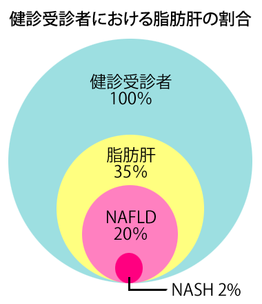 脂肪肝・脂肪肝炎