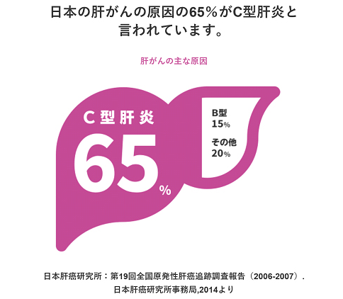 日本の肝がんの原因の65%がC型肝炎と言われています。