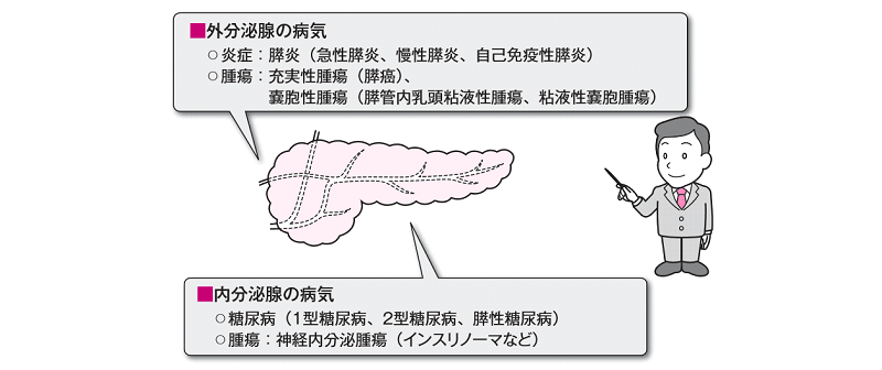 その他のすい臓の病気には以下のようなものがあります