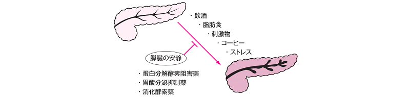 慢性膵炎の治療は生活習慣の改善と薬です