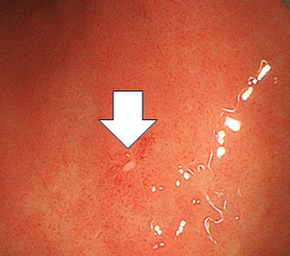 経験豊富な内視鏡技術